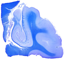 121 HippocampusCorpusGeniculatumLateralePlexusChoroideus queklueverBarrera 20 human