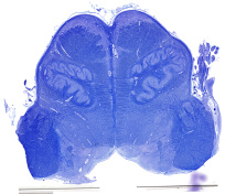 122 Myelencephalon_quer_6my_klueverBarrera_20_human