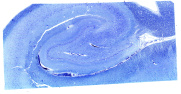 125_hippocampus_quer_semiduenn2my_klueverBarrera_20_human