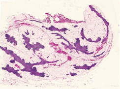 45 Thymus Mensch