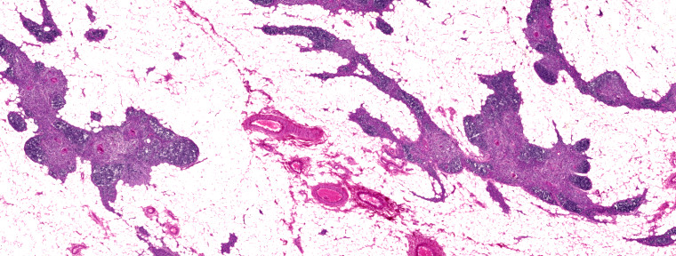 45 Thymus Mensch