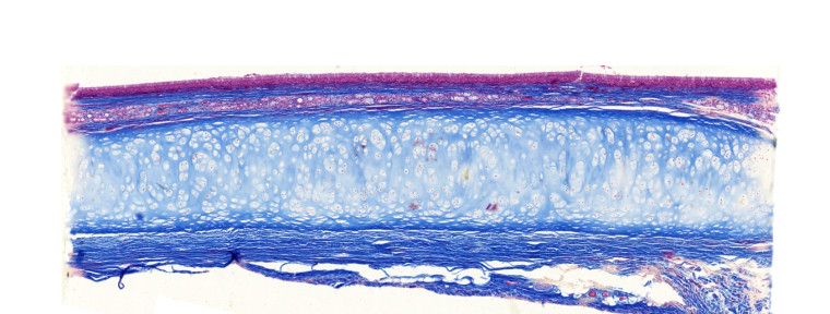 5 Trachea längs Mensch